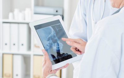 BMR medical cranioplastia